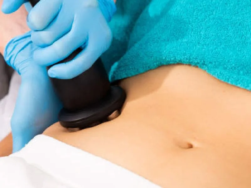 Radiofrecuencia facial Puebla